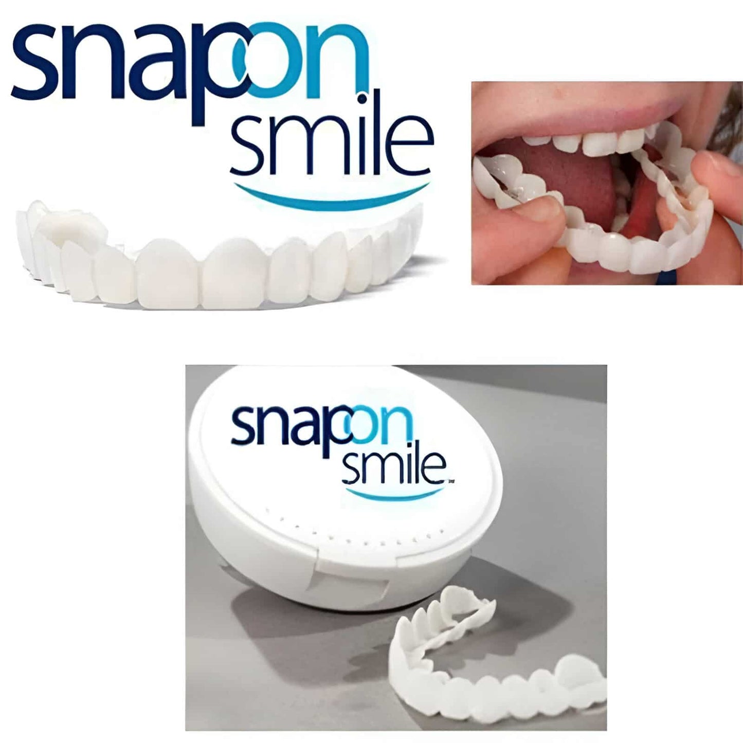SnapSmile™ - Set de 2 Carillas Dentales (Superior + Inferior)