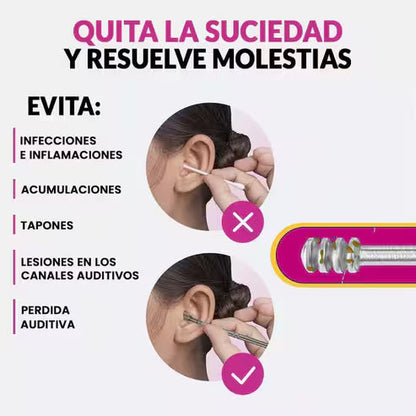 AurisKit® – Set Profesional para Limpieza de Oídos